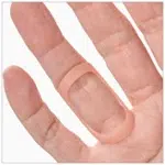 Oval-8 Finger Splints