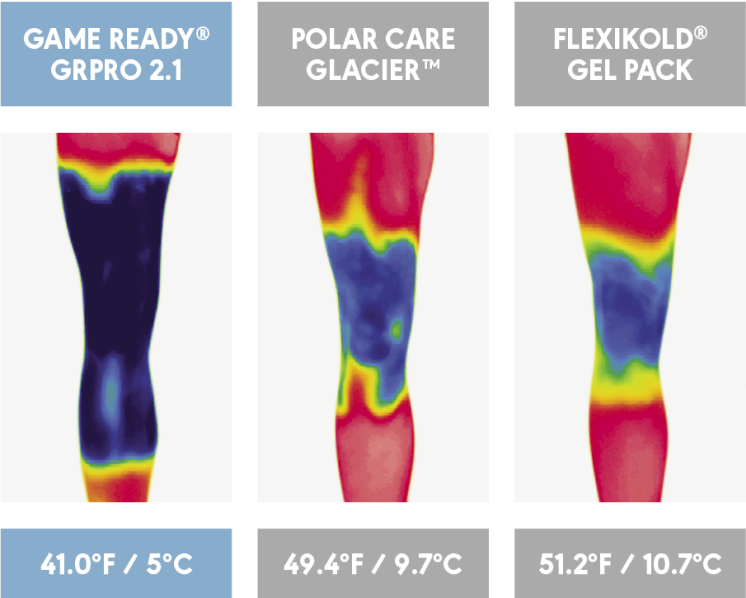 Game Ready Thermal reading of the knee. comparison between game ready and breg polar care and flexikold gel pack