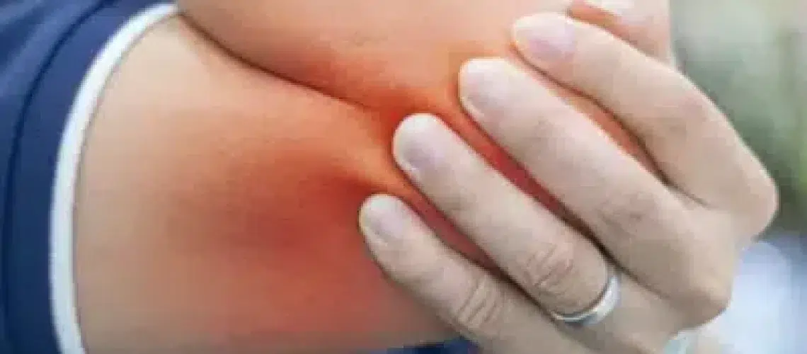Tennis-Elbow-427x427-400x400